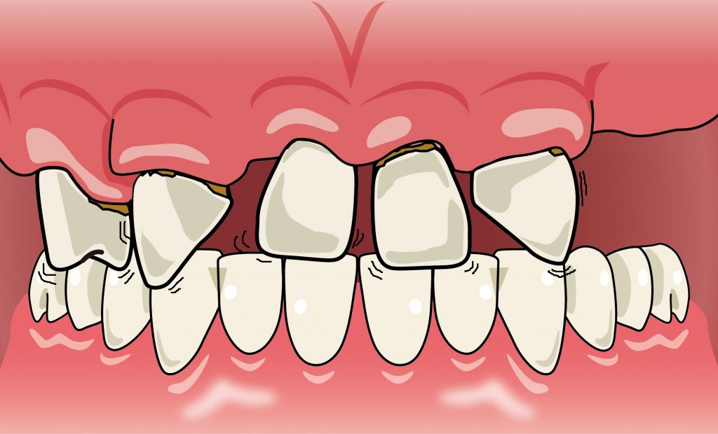 歯がぐらつく | 入れ歯が合わない | 噛むと痛い