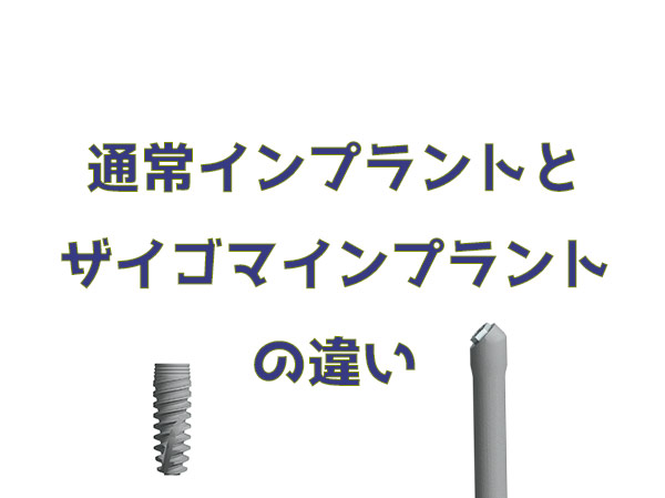 通常インプラント ザイゴマインプラント 違い