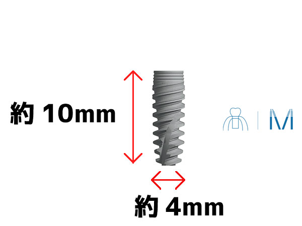 通常インプラントの形状