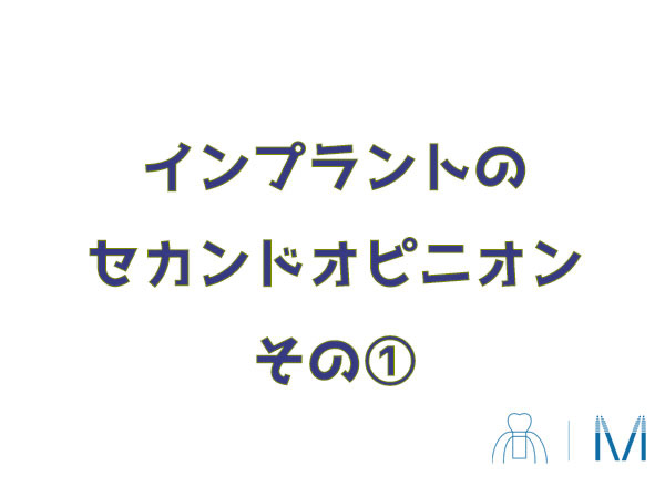 インプラント　セカンドオピニオン