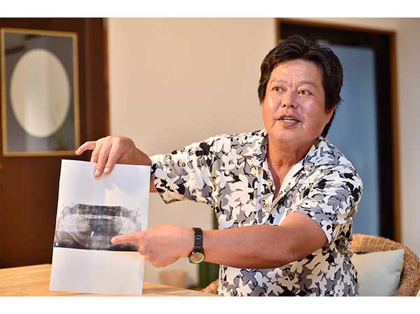 オールオンフォー ザイゴマ 体験談