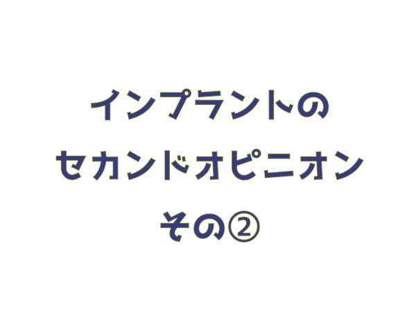 インプラント　セカンドオピニオン