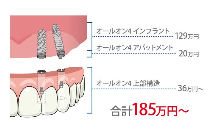 オールオン4 治療費