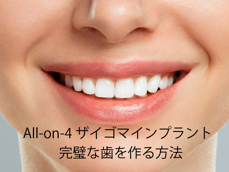 オールオン4 ザイゴマインプラント 完璧な歯
