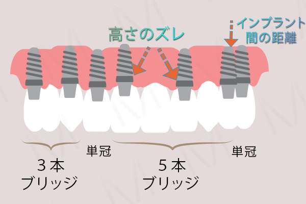 総インプラント