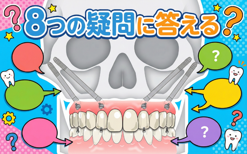 ザイゴマインプラント　疑問